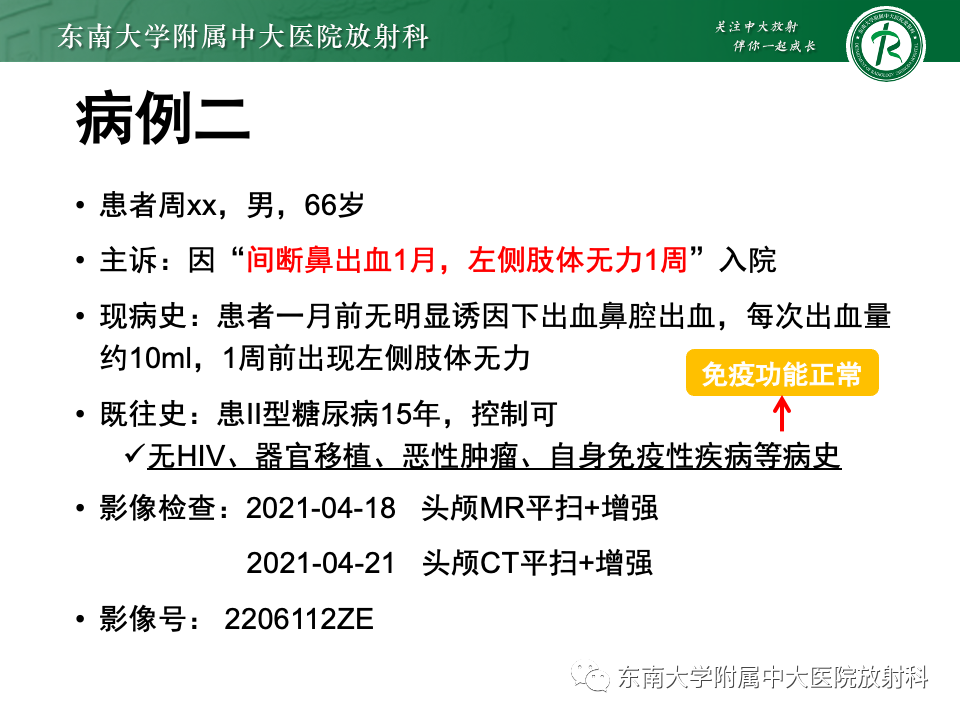 影像PPT - 【病例】胶质母细胞瘤 VS 原发性中枢神经系统淋巴瘤-16 影像PPT - 【病例】胶质母细胞瘤 VS 原发性中枢神经系统淋巴瘤-16