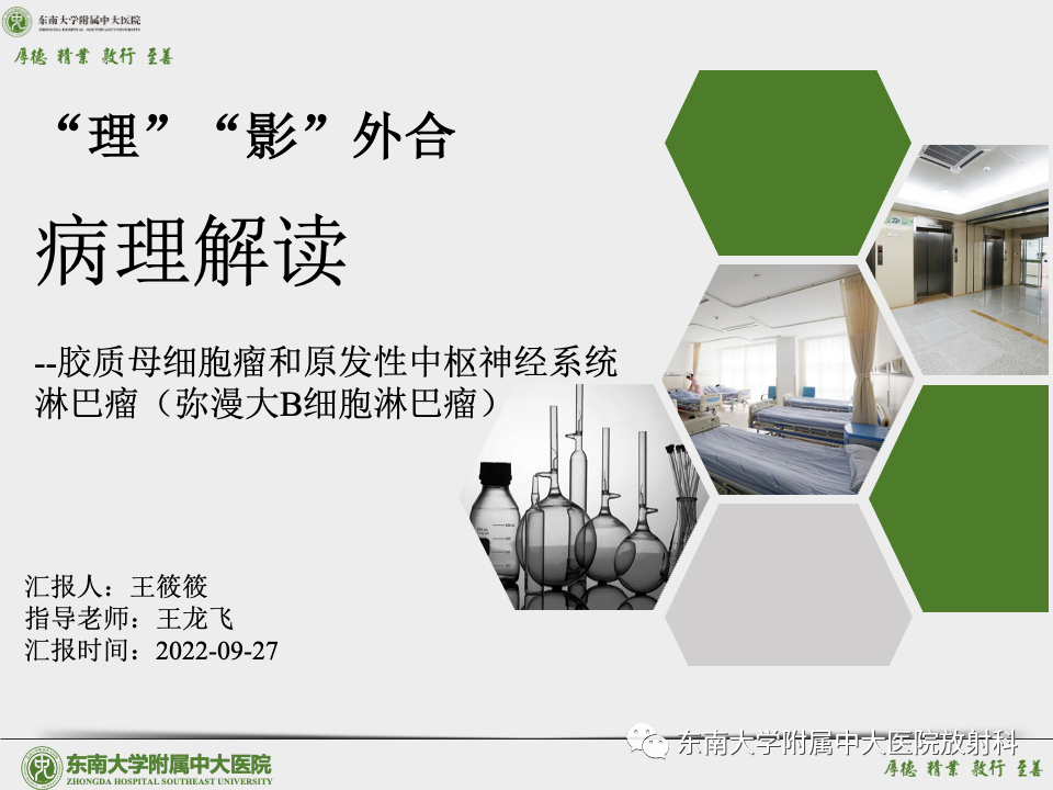 影像PPT - 【病例】胶质母细胞瘤 VS 原发性中枢神经系统淋巴瘤-24 影像PPT - 【病例】胶质母细胞瘤 VS 原发性中枢神经系统淋巴瘤-24