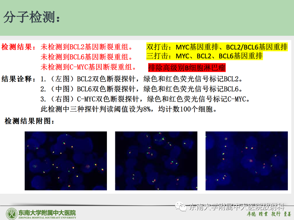 影像PPT - 【病例】胶质母细胞瘤 VS 原发性中枢神经系统淋巴瘤-48 影像PPT - 【病例】胶质母细胞瘤 VS 原发性中枢神经系统淋巴瘤-48