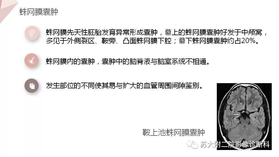 影像PPT - 【PPT】血管周围间隙的MRI表现-26