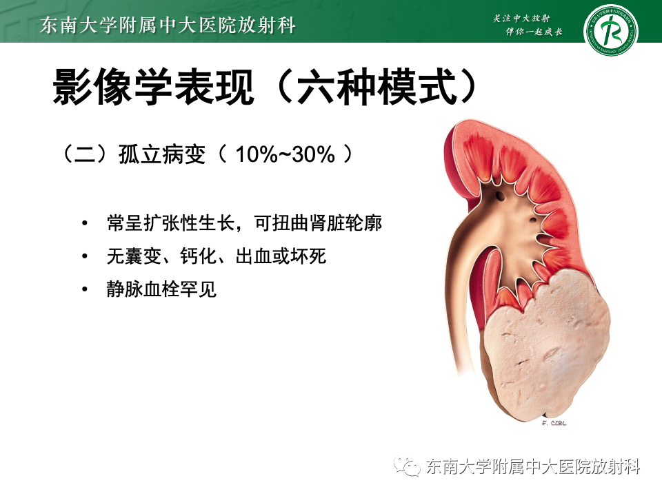 影像PPT - 【PPT】肾脏淋巴瘤-23
