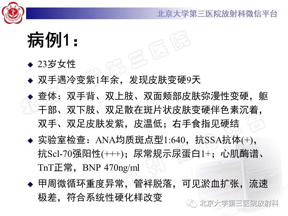 影像PPT - 【PPT】系统性硬化病心脏受累相关表现-2