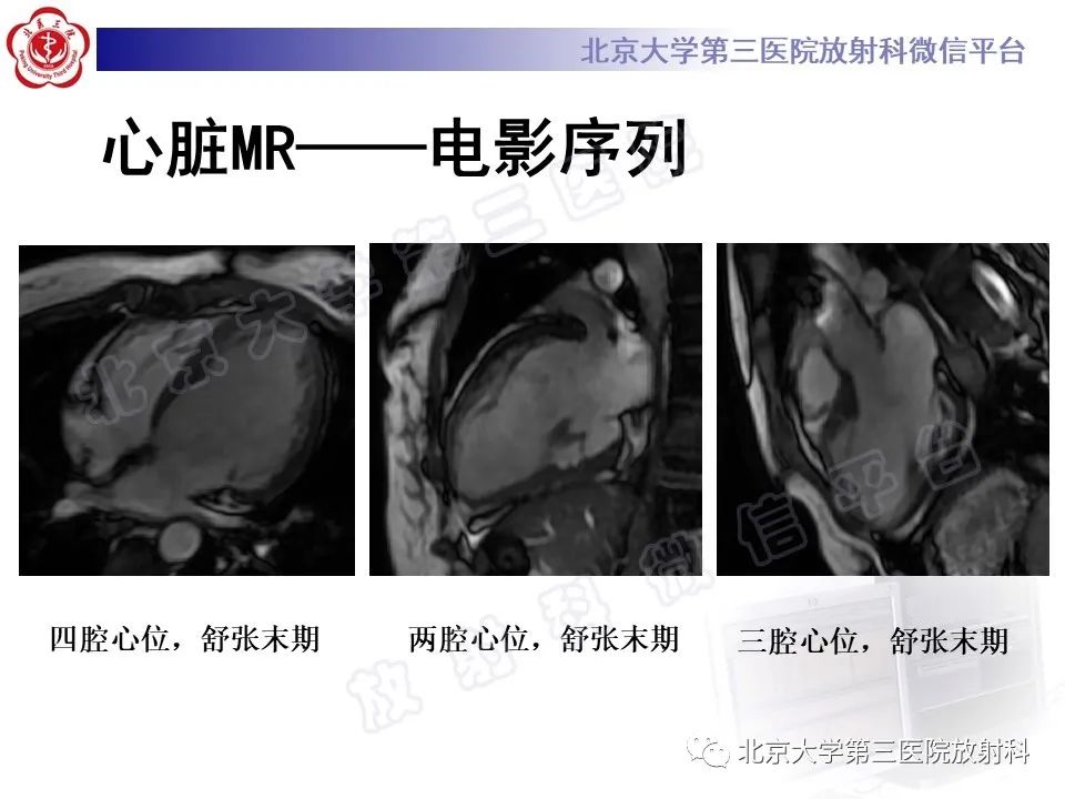 影像PPT - 【PPT】系统性硬化病心脏受累相关表现-4