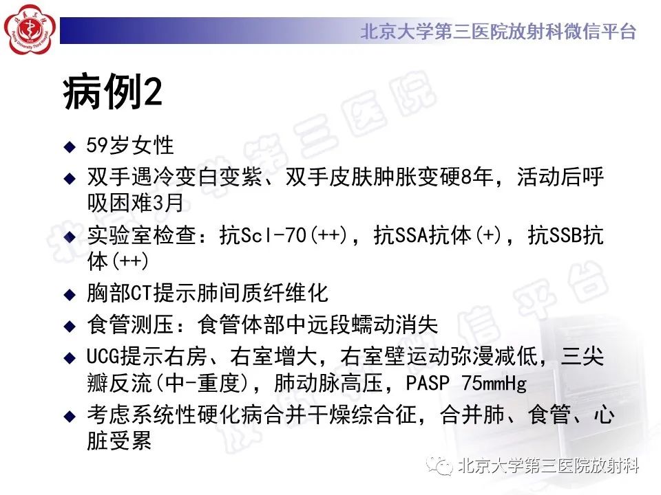 影像PPT - 【PPT】系统性硬化病心脏受累相关表现-9