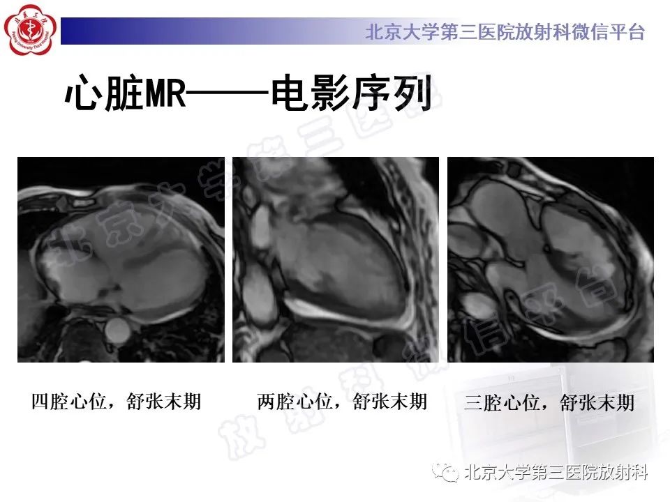 影像PPT - 【PPT】系统性硬化病心脏受累相关表现-11