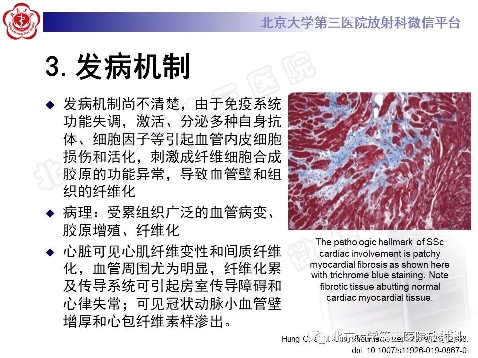 影像PPT - 【PPT】系统性硬化病心脏受累相关表现-19