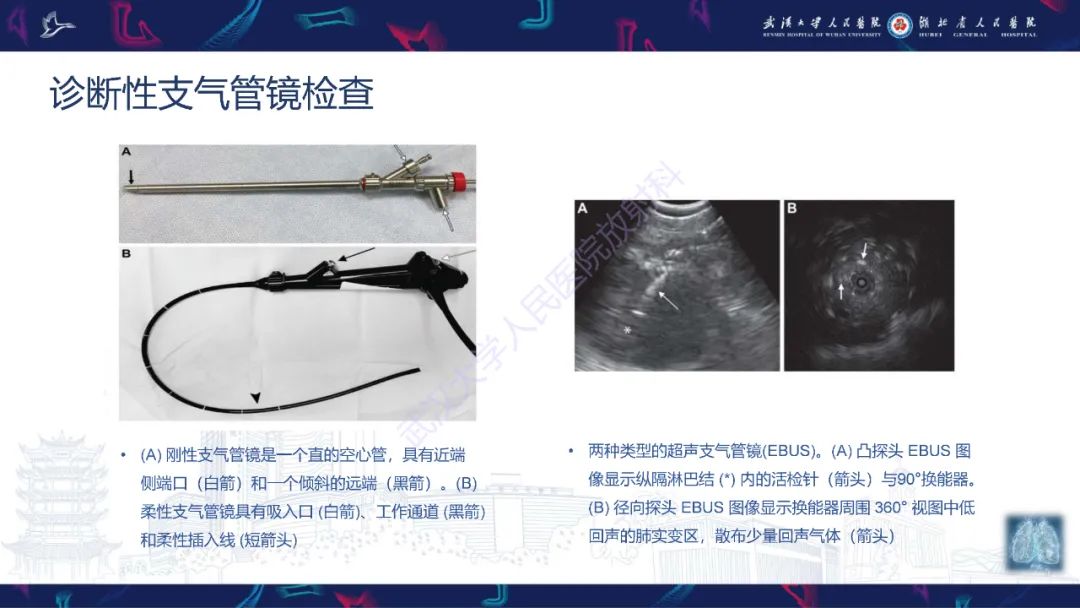 影像PPT - 【PPT】介入呼吸病学：放射科医师需要了解的知识-5