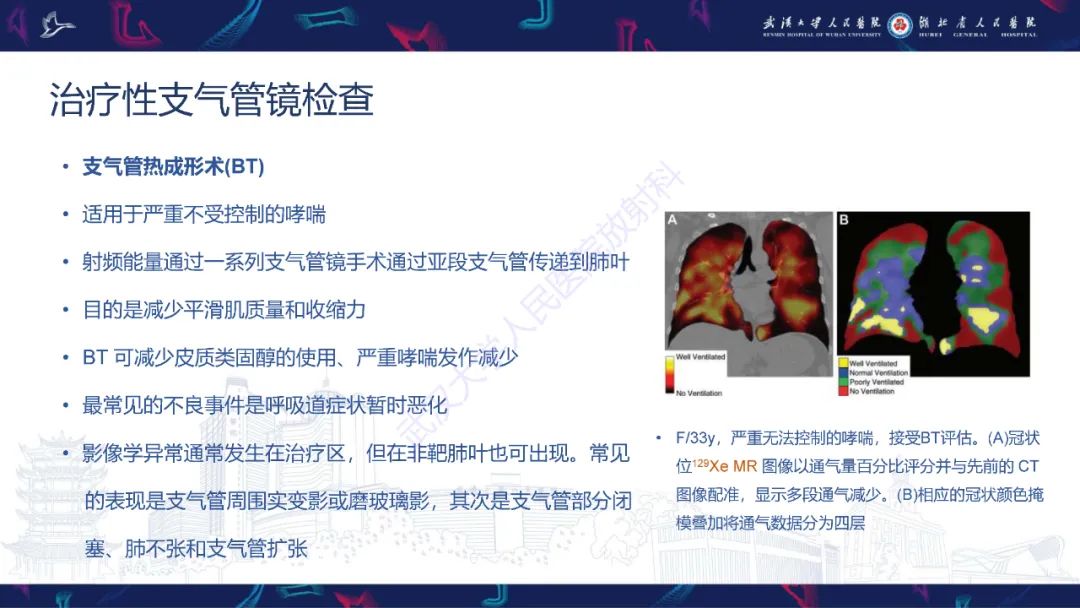 影像PPT - 【PPT】介入呼吸病学：放射科医师需要了解的知识-28