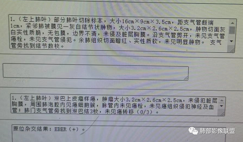 影像PPT - 【病例】中年女性的肺部富血供占位-22 影像PPT - 【病例】中年女性的肺部富血供占位-22