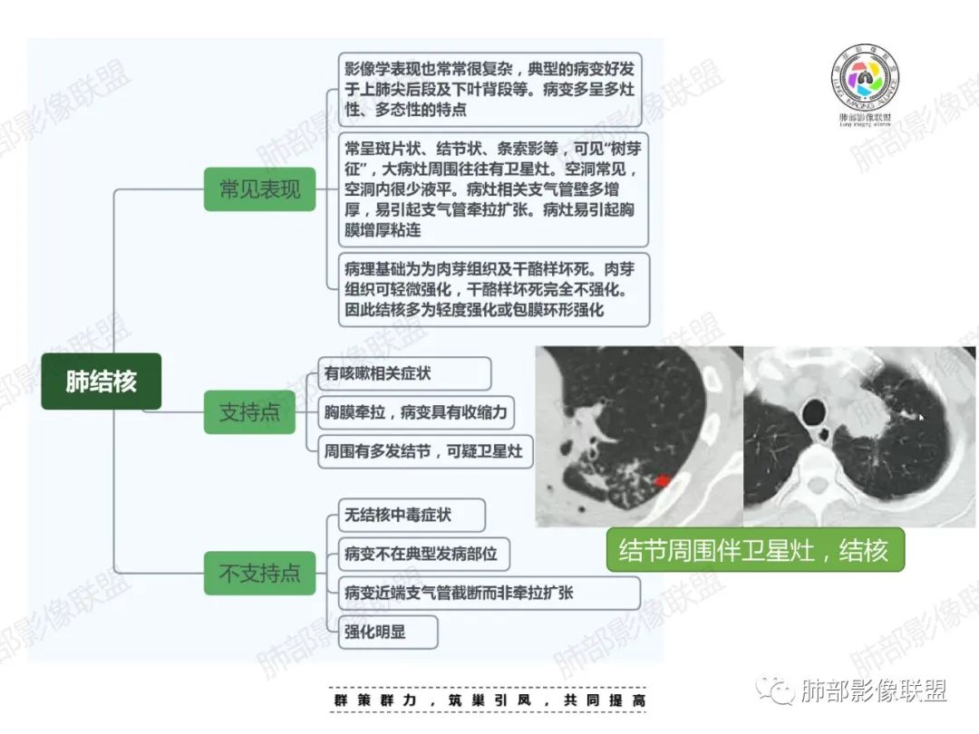影像PPT - 【病例】中年女性的肺部富血供占位-25 影像PPT - 【病例】中年女性的肺部富血供占位-25