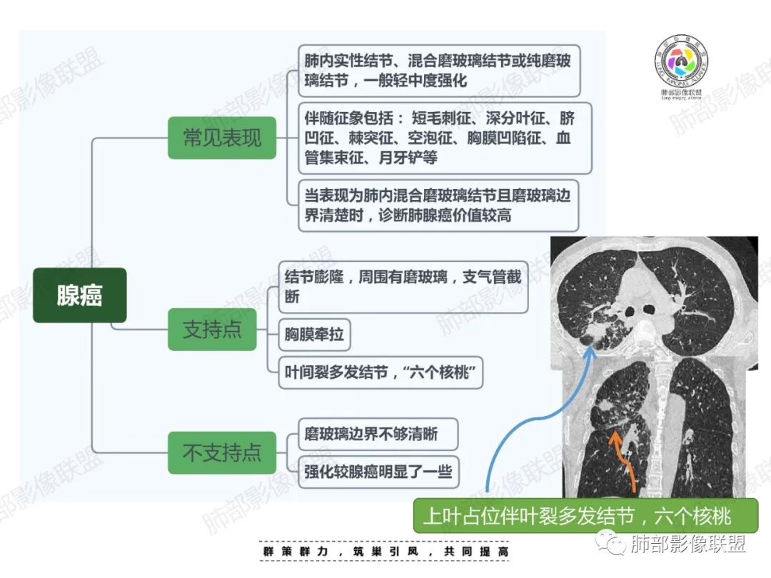 影像PPT - 【病例】中年女性的肺部富血供占位-28 影像PPT - 【病例】中年女性的肺部富血供占位-28