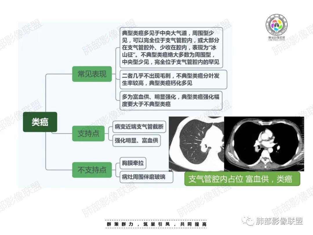 影像PPT - 【病例】中年女性的肺部富血供占位-29 影像PPT - 【病例】中年女性的肺部富血供占位-29