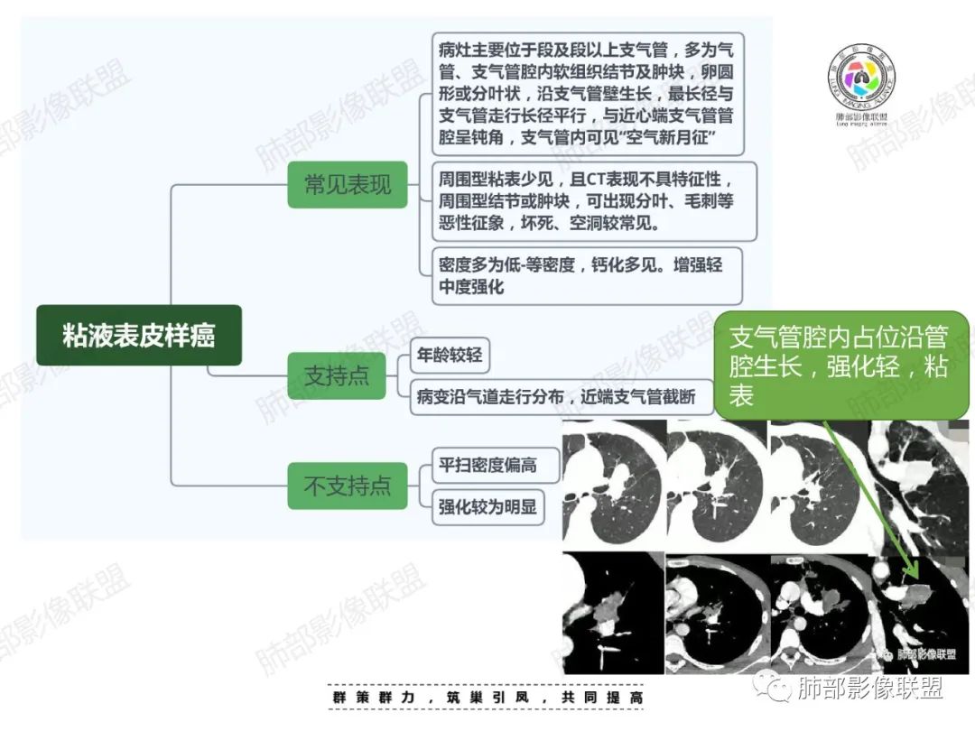 影像PPT - 【病例】中年女性的肺部富血供占位-30 影像PPT - 【病例】中年女性的肺部富血供占位-30