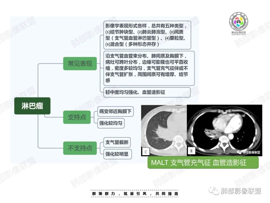 影像PPT - 【病例】中年女性的肺部富血供占位-31 影像PPT - 【病例】中年女性的肺部富血供占位-31