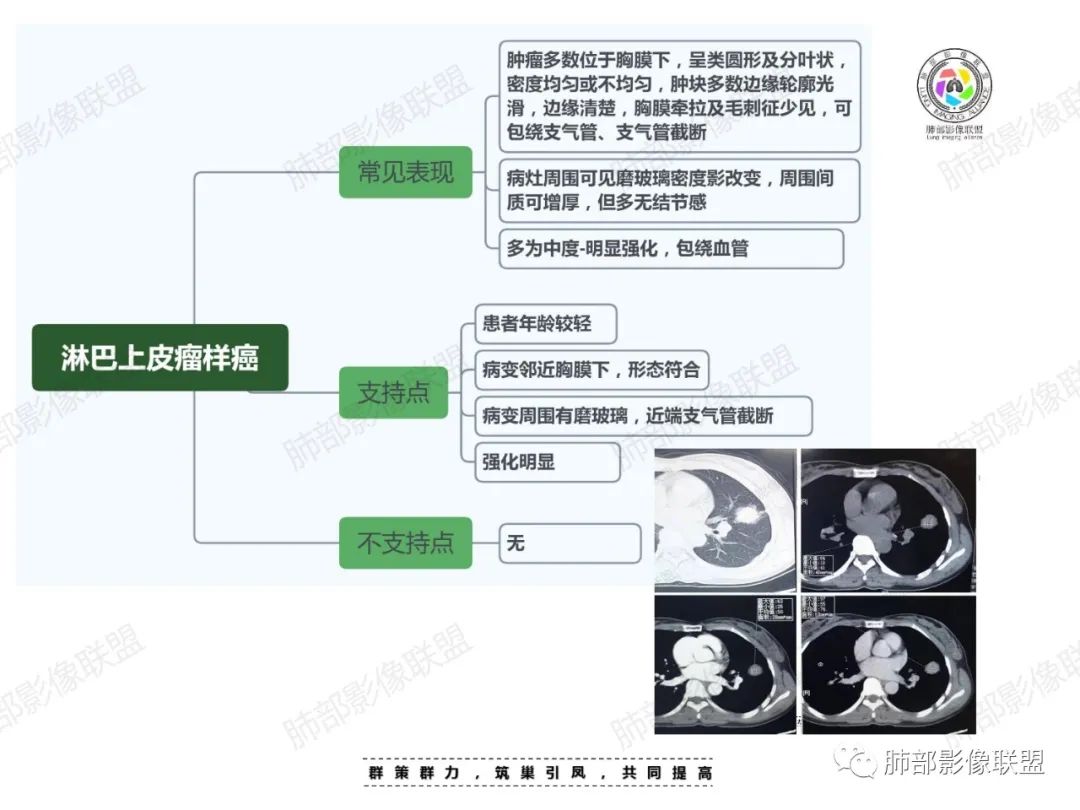 影像PPT - 【病例】中年女性的肺部富血供占位-32 影像PPT - 【病例】中年女性的肺部富血供占位-32