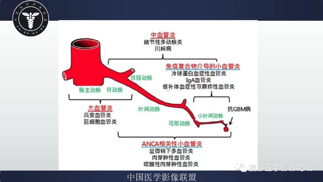 影像PPT - 【病例】巨细胞动脉炎累及肾脏1例CT影像-13