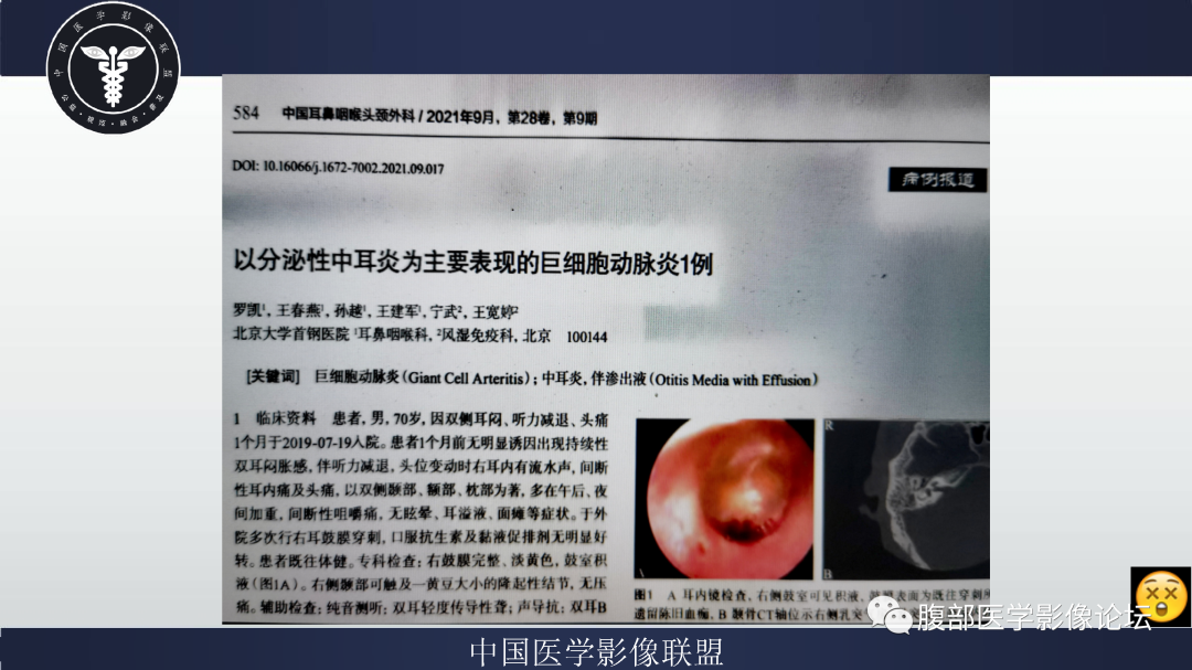 影像PPT - 【病例】巨细胞动脉炎累及肾脏1例CT影像-17