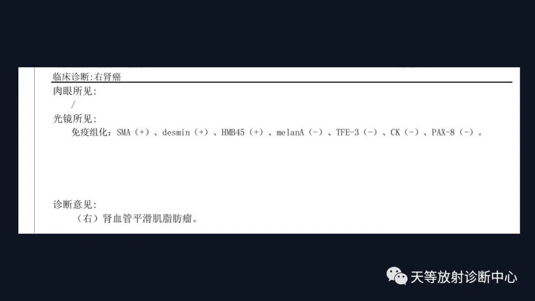 影像PPT - 【病例】肾血管平滑肌脂肪瘤1例CT影像-17 影像PPT - 【病例】肾血管平滑肌脂肪瘤1例CT影像-17