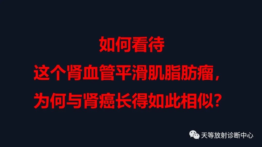 影像PPT - 【病例】肾血管平滑肌脂肪瘤1例CT影像-19 影像PPT - 【病例】肾血管平滑肌脂肪瘤1例CT影像-19