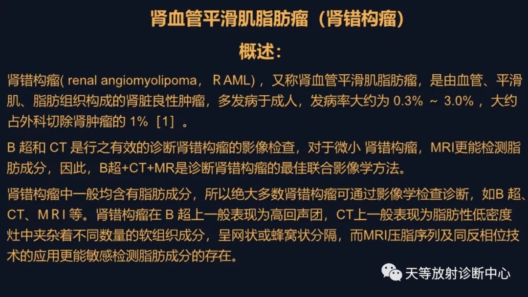 影像PPT - 【病例】肾血管平滑肌脂肪瘤1例CT影像-20 影像PPT - 【病例】肾血管平滑肌脂肪瘤1例CT影像-20