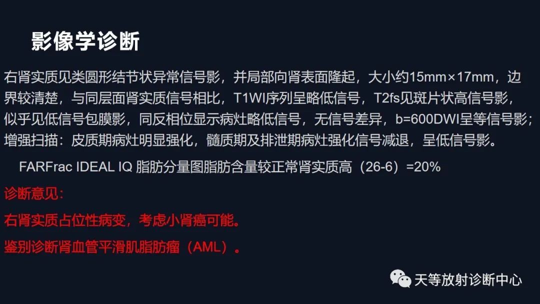 影像PPT - 【病例】肾血管平滑肌脂肪瘤1例CT影像-35 影像PPT - 【病例】肾血管平滑肌脂肪瘤1例CT影像-35
