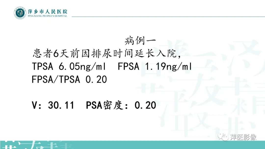 影像PPT - 【PPT】前列腺PI-RADS评分含解读-2