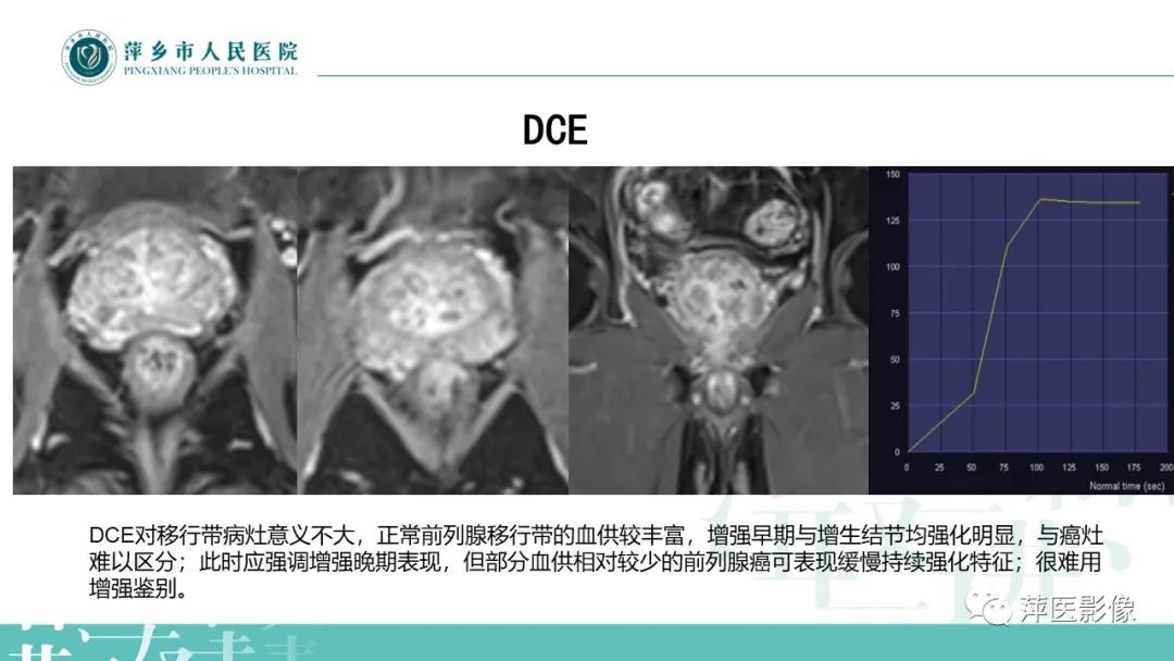影像PPT - 【PPT】前列腺PI-RADS评分含解读-5