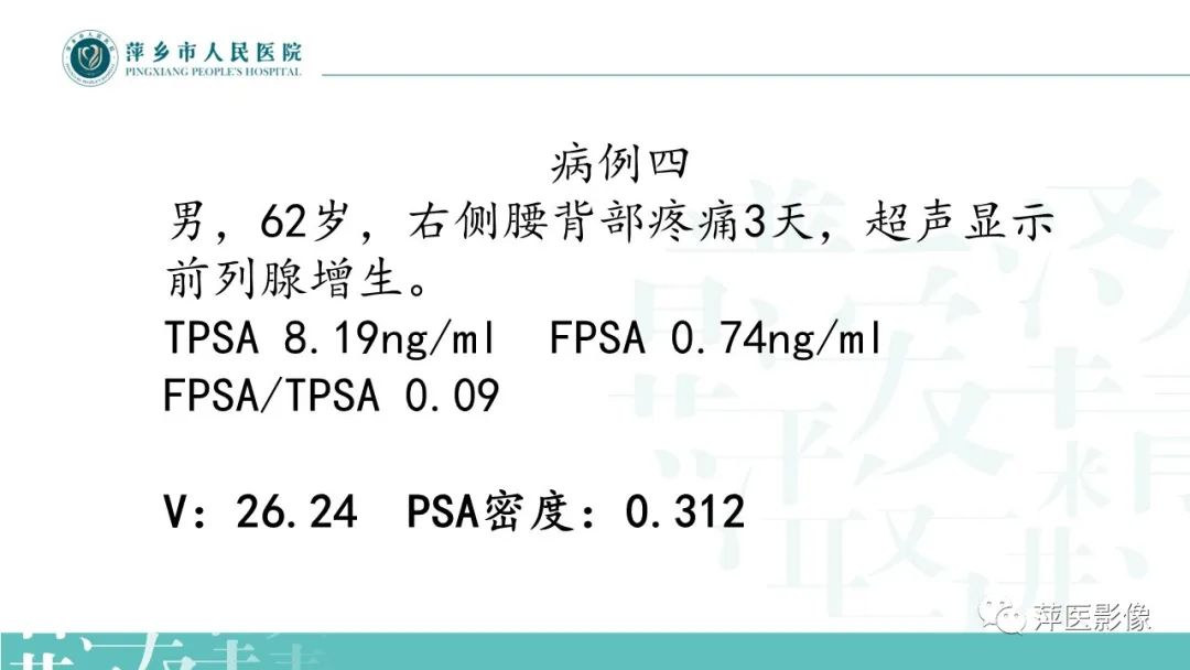 影像PPT - 【PPT】前列腺PI-RADS评分含解读-17