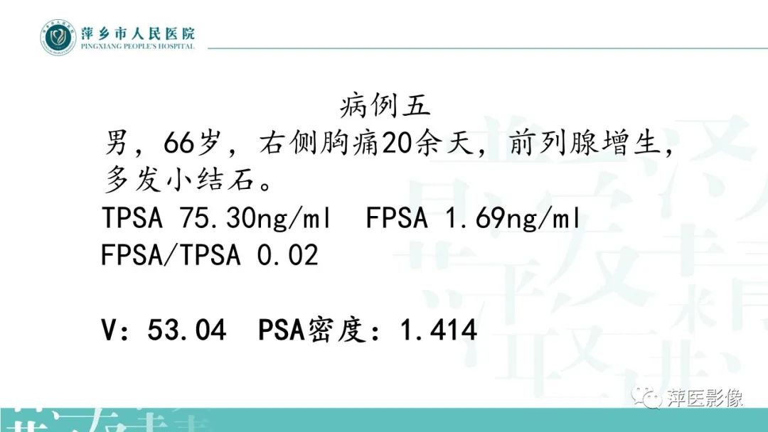 影像PPT - 【PPT】前列腺PI-RADS评分含解读-22