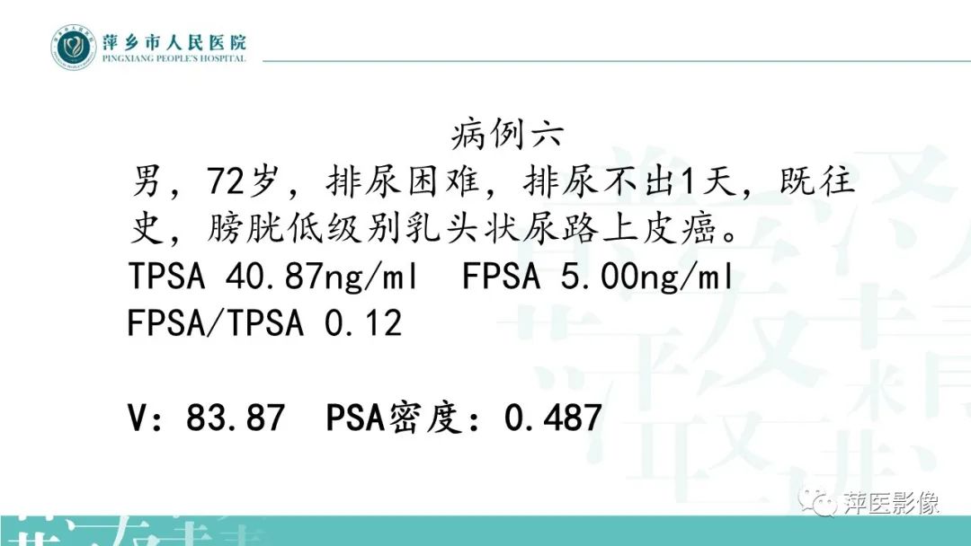 影像PPT - 【PPT】前列腺PI-RADS评分含解读-26