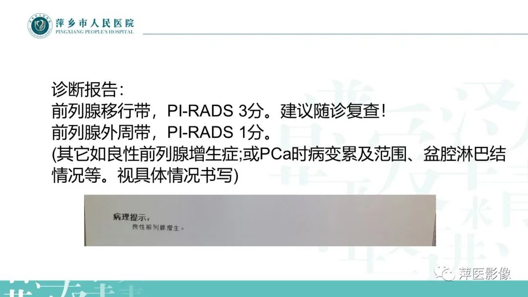 影像PPT - 【PPT】前列腺PI-RADS评分含解读-30