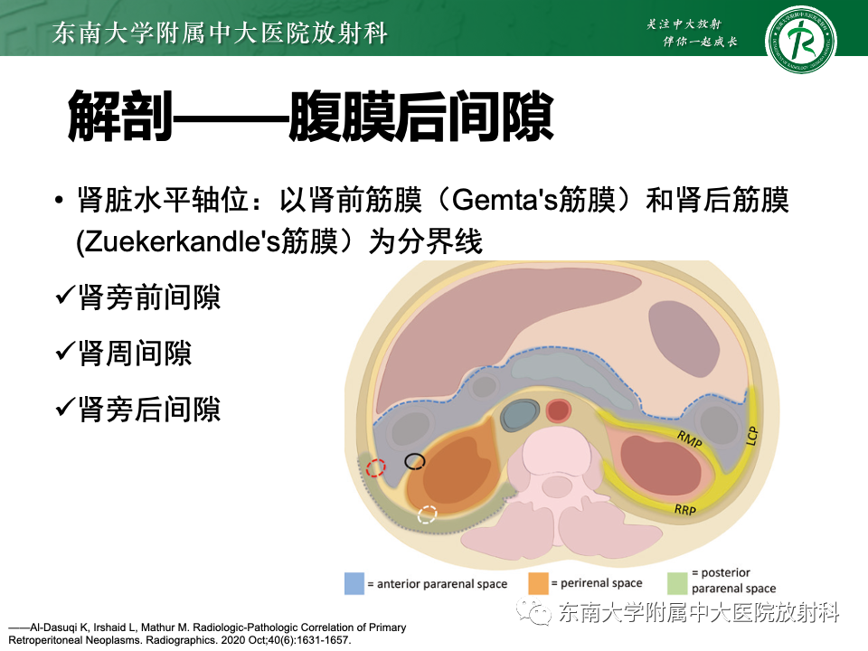 影像PPT - 【PPT】腹膜后平滑肌肉瘤-8