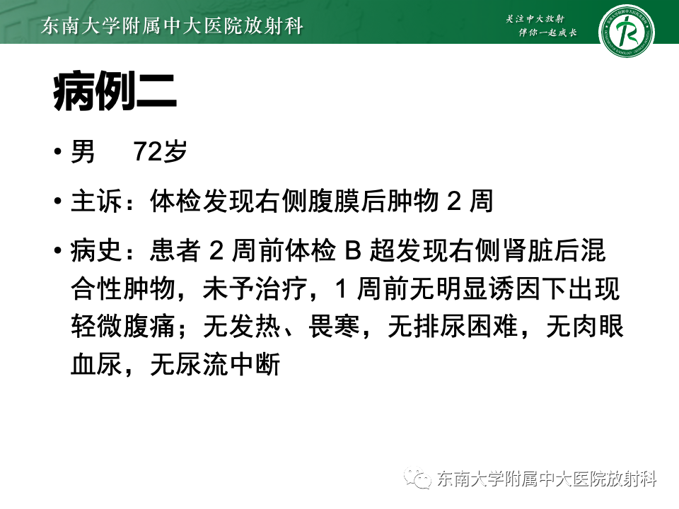 影像PPT - 【PPT】腹膜后平滑肌肉瘤-22