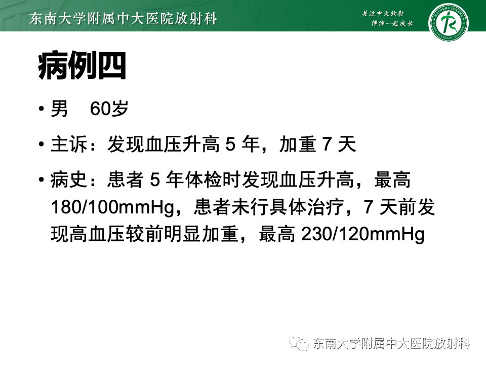 影像PPT - 【PPT】腹膜后平滑肌肉瘤-28