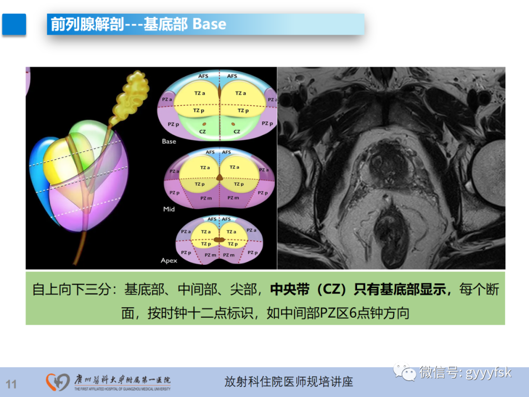 影像PPT - 【PPT】前列腺癌的MR扫描规范及精准诊断-12