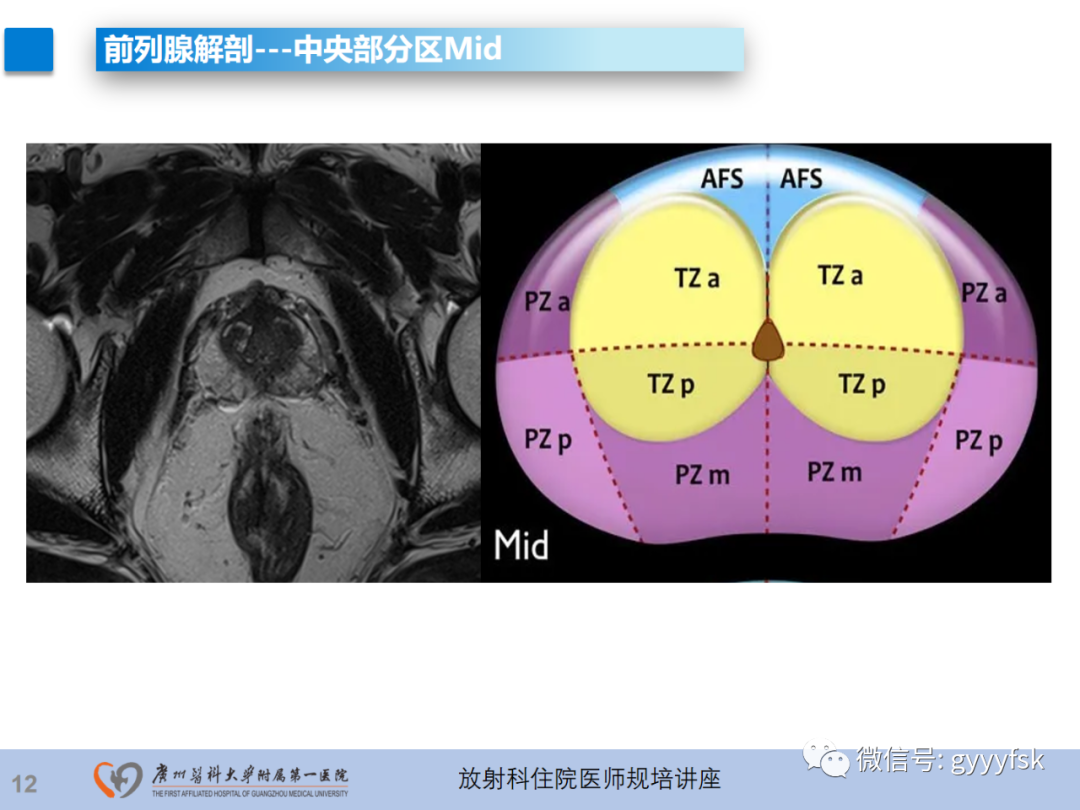 影像PPT - 【PPT】前列腺癌的MR扫描规范及精准诊断-13
