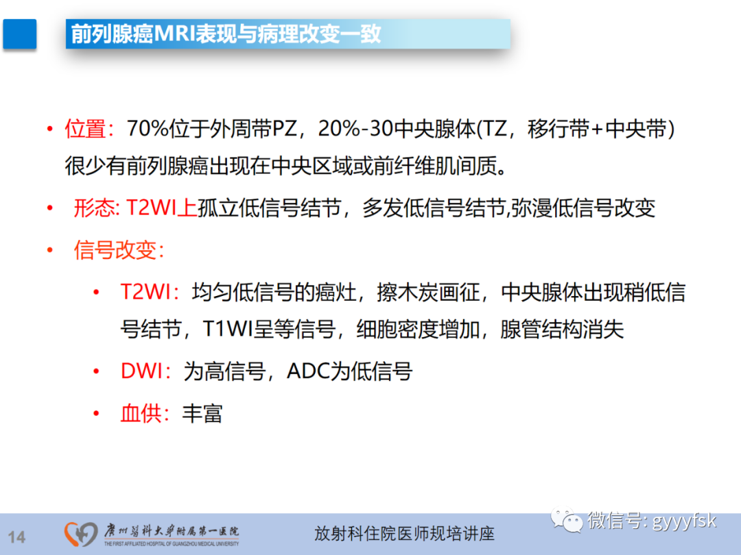 影像PPT - 【PPT】前列腺癌的MR扫描规范及精准诊断-15