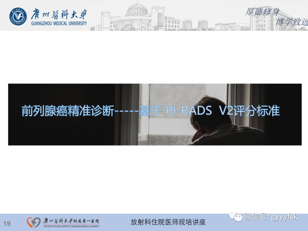 影像PPT - 【PPT】前列腺癌的MR扫描规范及精准诊断-20