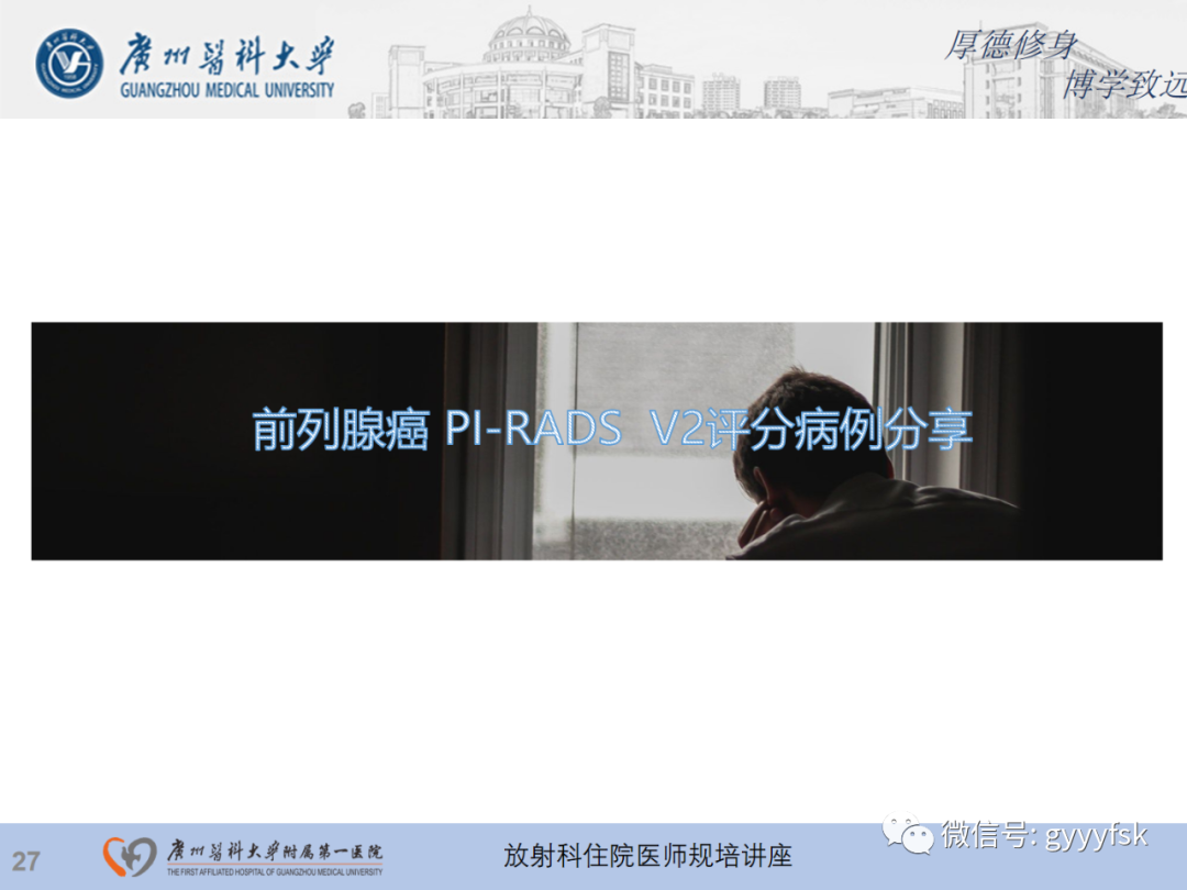 影像PPT - 【PPT】前列腺癌的MR扫描规范及精准诊断-28