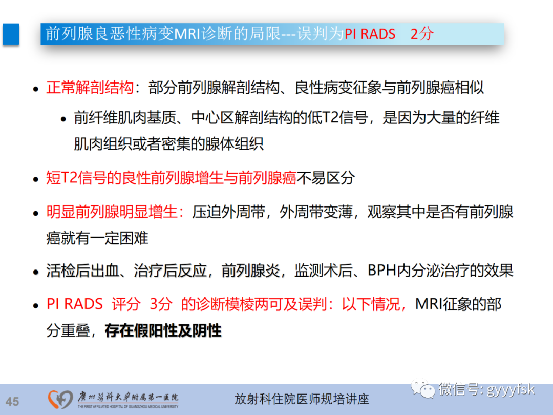 影像PPT - 【PPT】前列腺癌的MR扫描规范及精准诊断-46