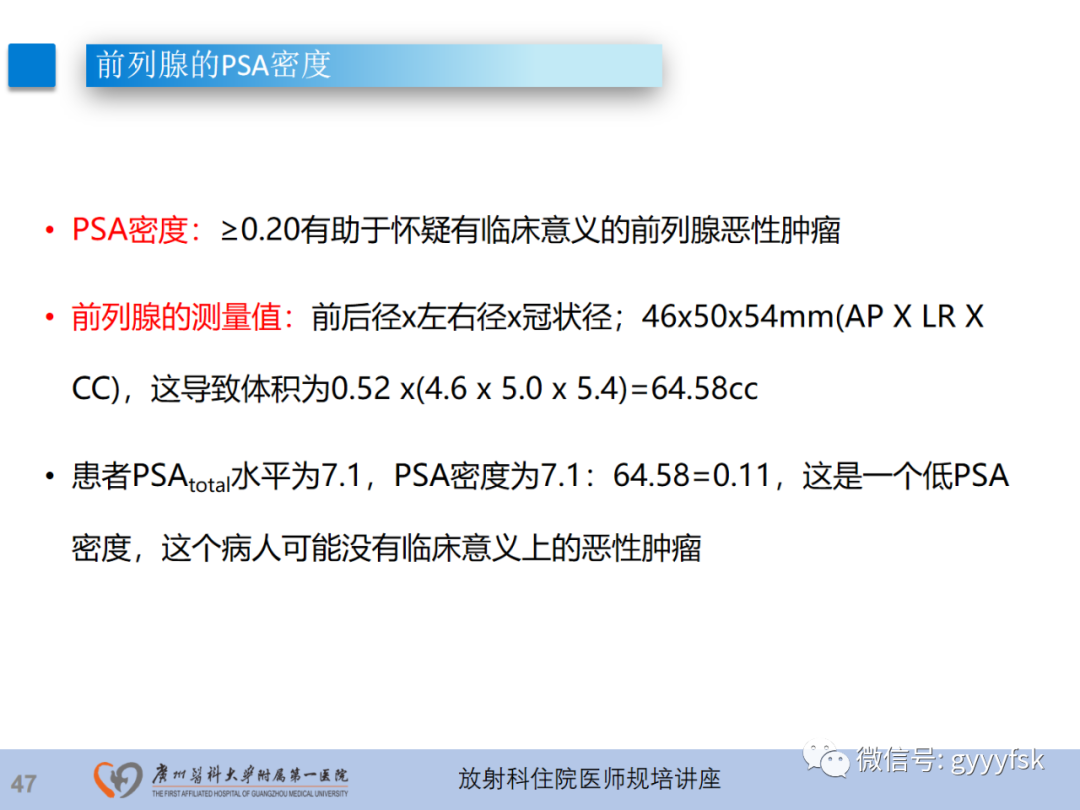 影像PPT - 【PPT】前列腺癌的MR扫描规范及精准诊断-48