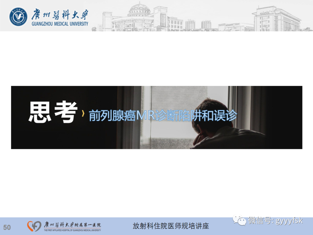 影像PPT - 【PPT】前列腺癌的MR扫描规范及精准诊断-51