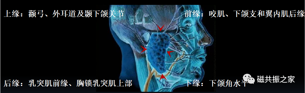 影像PPT - 腮腺MRI该如何扫描-1 影像PPT - 腮腺MRI该如何扫描-1