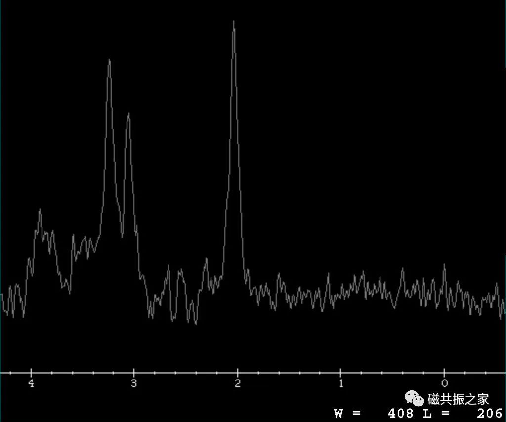 影像PPT - 海马MRI该如何扫描-13 影像PPT - 海马MRI该如何扫描-13