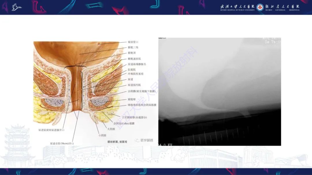 影像PPT - 【PPT】尿道造影疾病诊断-5