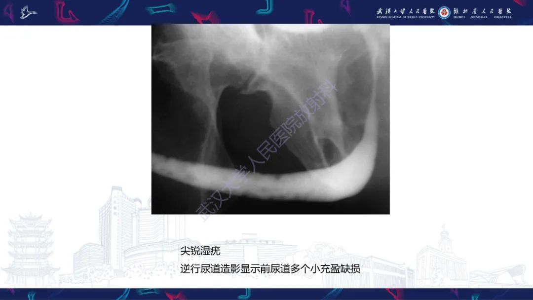 影像PPT - 【PPT】尿道造影疾病诊断-48