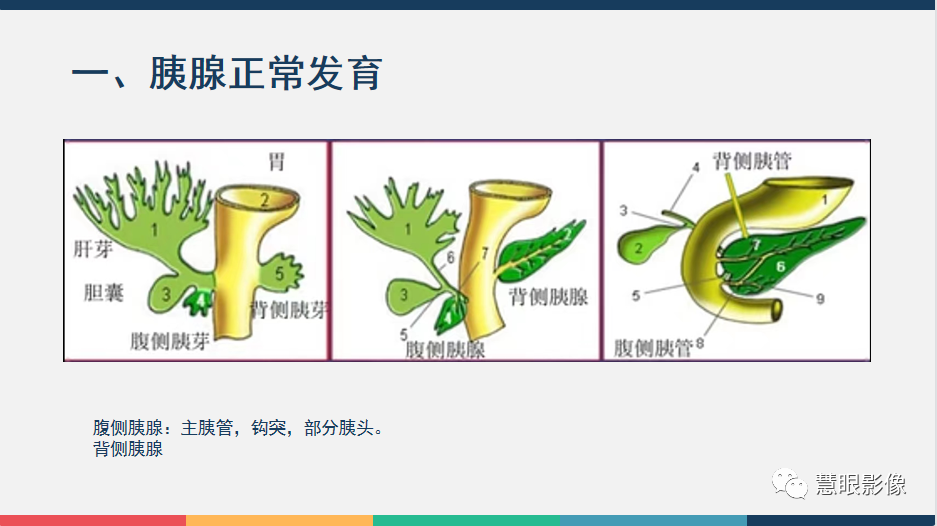 影像PPT - 【PPT】胰腺解剖变异、发育异常及相关病变影像评估-3