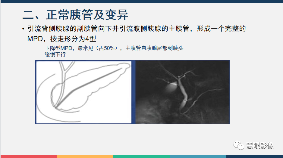 影像PPT - 【PPT】胰腺解剖变异、发育异常及相关病变影像评估-6