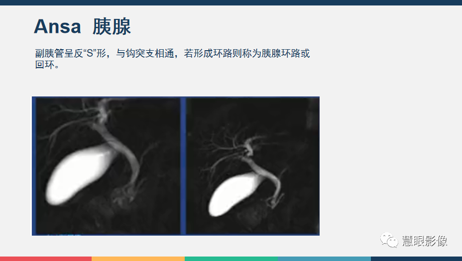 影像PPT - 【PPT】胰腺解剖变异、发育异常及相关病变影像评估-11
