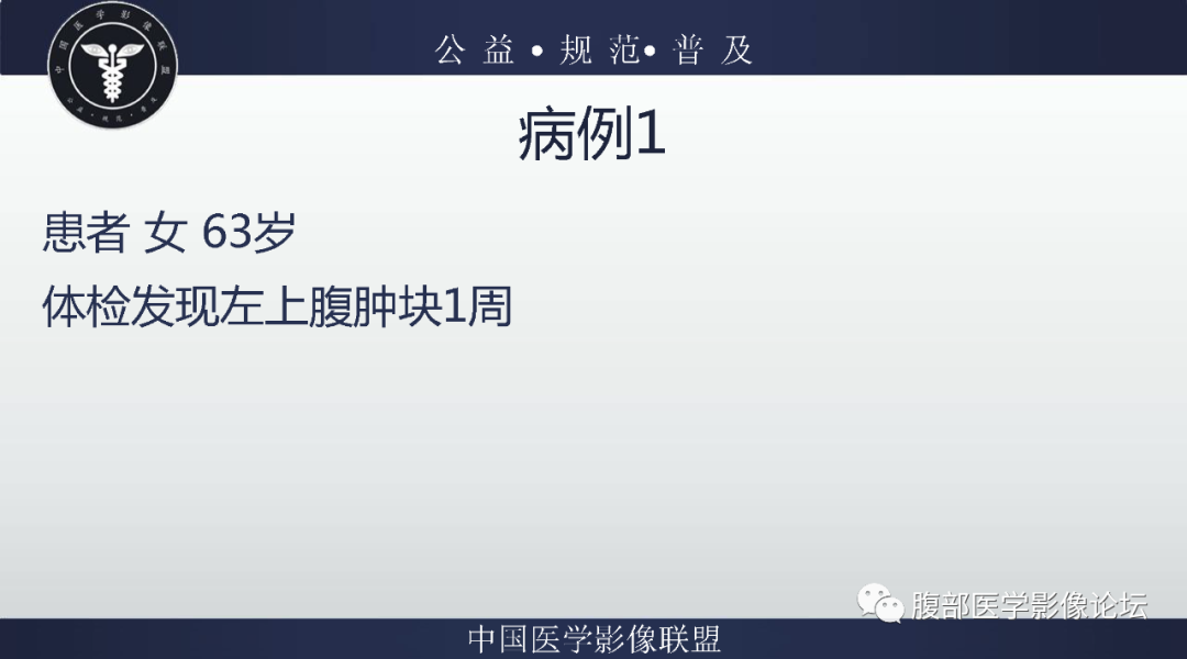 影像PPT - 【病例】腹膜后副神经节瘤1例CT影像-2